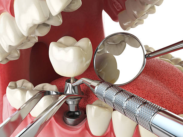 Best Emergency Care for Gum Disease in Basile, LA